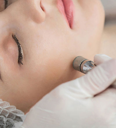 FACELIFT (MICRODERMABRASION) FACIAL